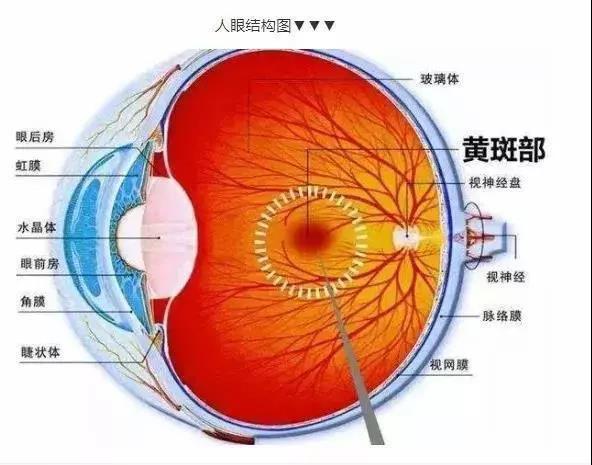 黄斑病变怎样治疗?