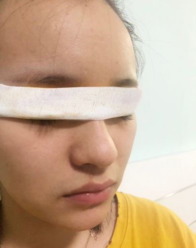 目前还是有点肿,说实话手术刚结束,还有点难受,医生帮我看了伤口的