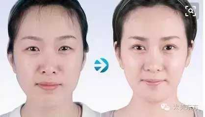 没有苹果肌, 再美的冻龄女神也会成老女人