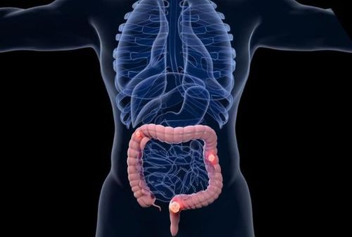 什么病引起左侧腹部疼痛?去医院要做什么检查?提前了解下