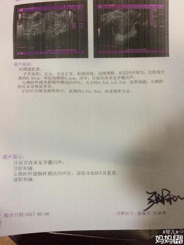 上饶妇幼保健院做腹腔镜手术多少钱