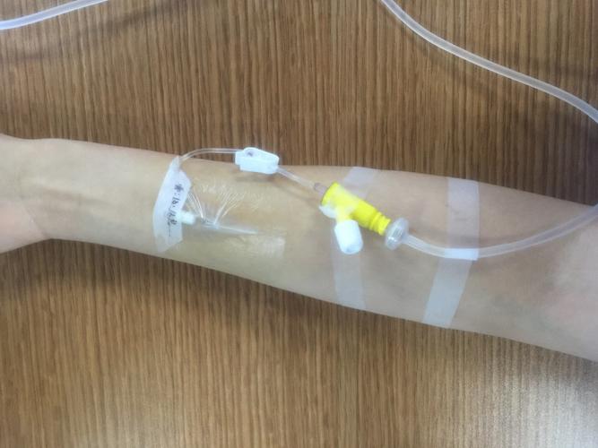 提高护理技能水平——宣化区医院护理部举行了静脉留置针穿刺技术培训