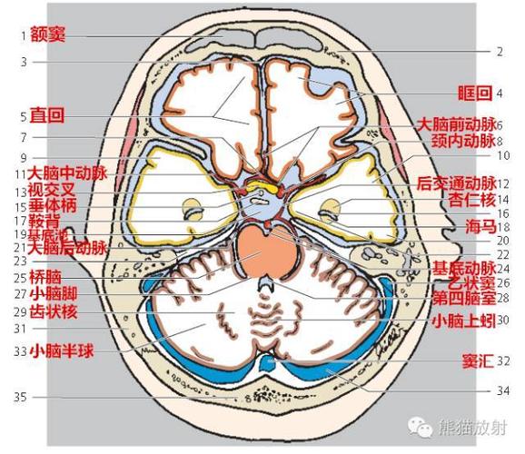 解剖入门颅脑ct断层中英文对照