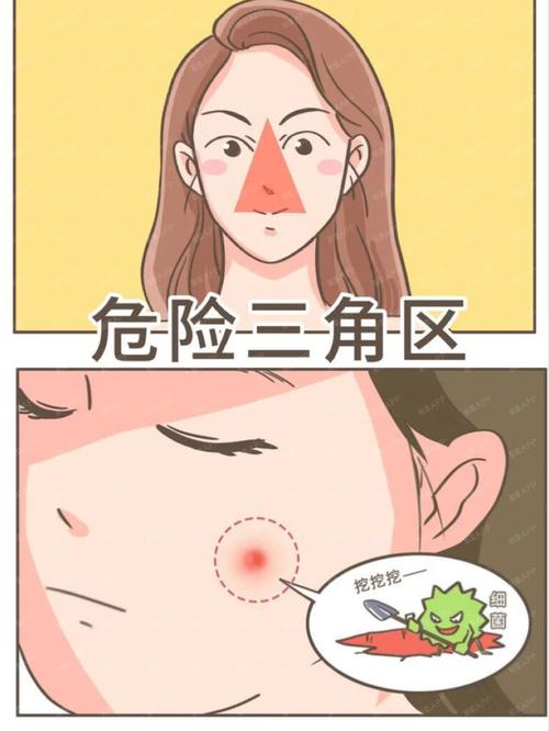 挤痘痘可能会引发严重的感染问题,特别是长在面部三角区的痘痘可千万