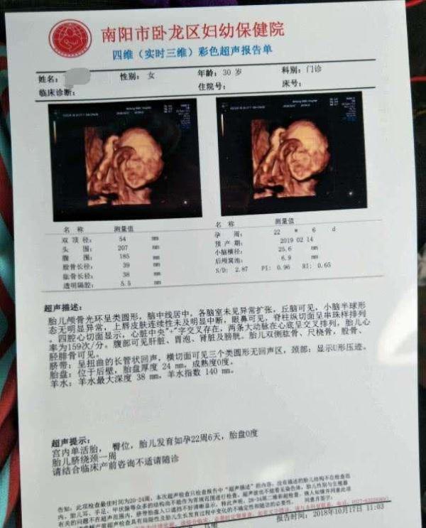 四维彩超报告单上的数据,你看懂了吗?3分钟让你更详细