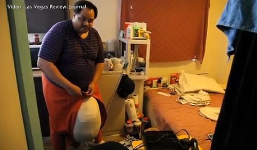 男子睾丸重89斤