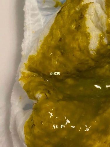拉的便便有虫子?介意勿看_辅食_母乳_人类幼崽成长记