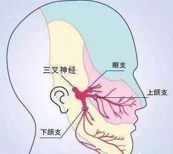 三叉神经痛,痛不欲生!这样灸最有效 赶快来试试!