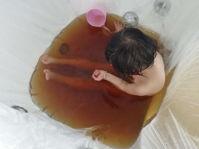 凤冈县妇幼保健院水育中心开展小儿药浴