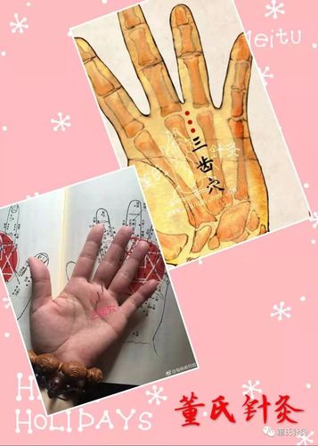 董氏针灸林正泰之牙齿疾病处方穴