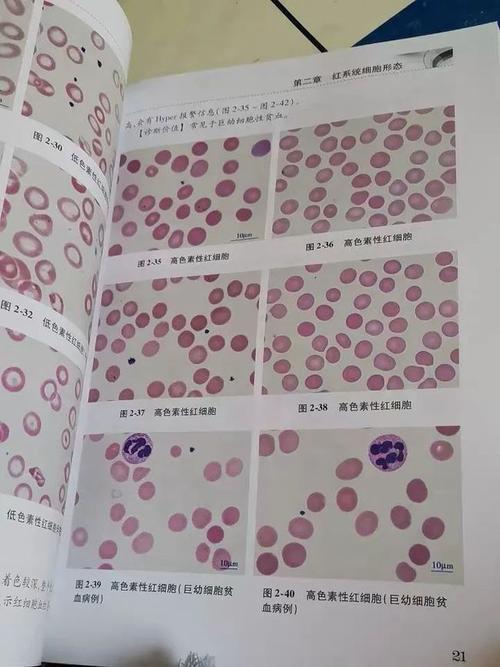 高清图谱,外周血细胞检验知识全覆盖!