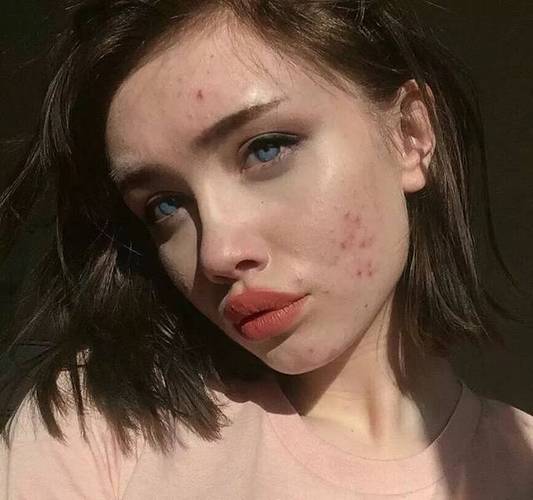 omg丨满脸痘痘却当上美妆博主,原来ins上的网红们也是照骗?