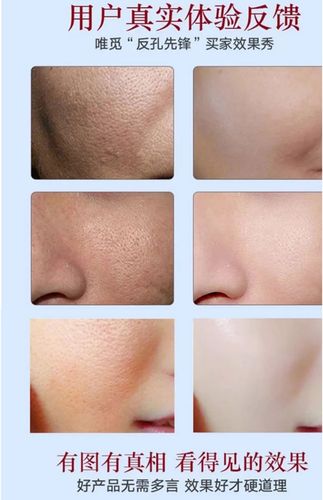 展示与对比:毛孔粗大修复女2018克星恢复缩小去黑头水