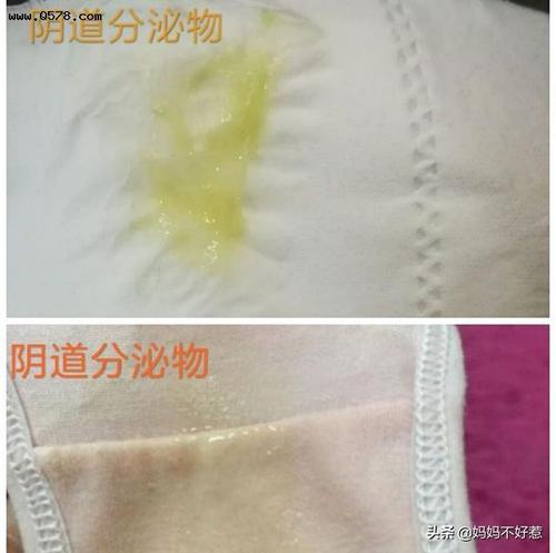 孕晚期总是流水,会是羊水破了吗?