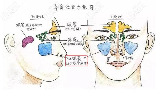 种植牙为什么还要提升上颌窦难道是为了增加费用
