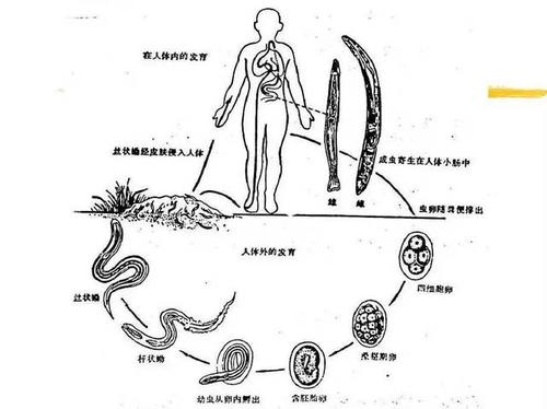 对于钩虫,你了解多少?