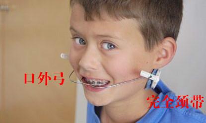 头帽牵引装置--安全颈带:可伸缩调节 长度 配合口外弓使用