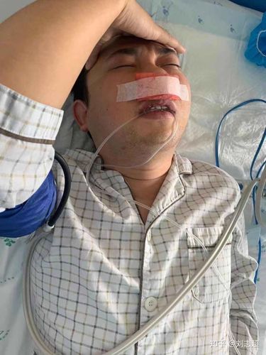 全组鼻窦炎开放及鼻息肉手术经历