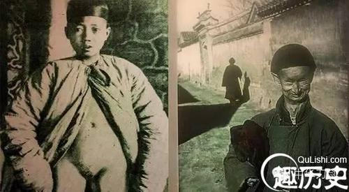历史揭秘:古代残酷的太监阉割术 死亡率竟达两成
