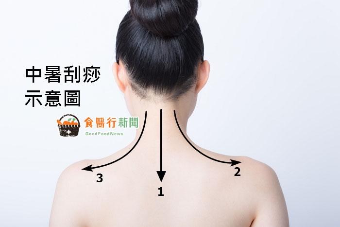 夏日防中暑!中医传授解热刮痧法 4大饮品有效散热