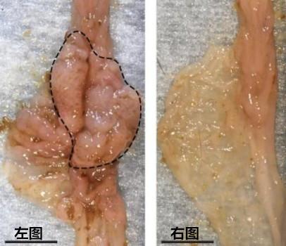 左图:小鼠肠道肿瘤(息肉)的发展 右图:通过改变肠道菌群组成息肉被