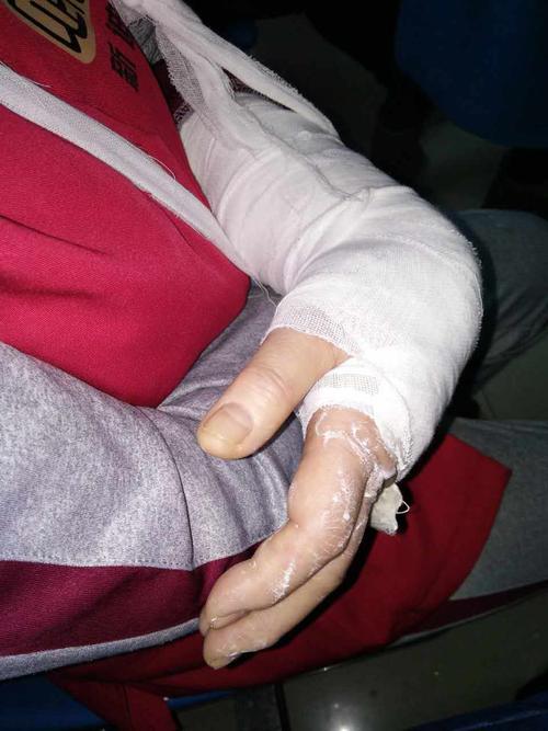 请问我妈在超市因水渍摔断手,要找谁负责?