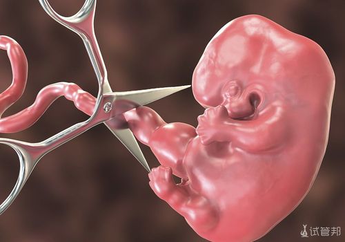 胚胎停育做药流还是做人流