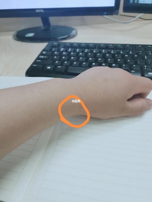 孕34 得了95腱鞘炎,腕管综合征_腱鞘炎_孕期_空调_孕期腕管综合征