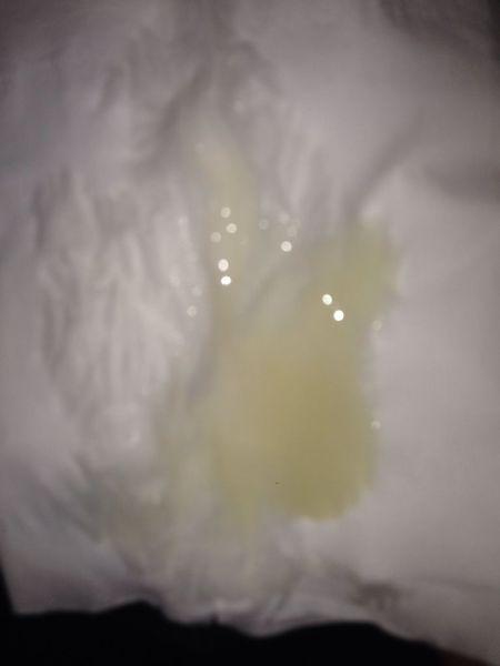 一星期一次sy 精子是这样的正常么 不正经的别说话 有