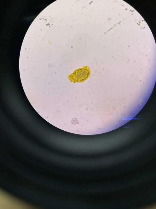 衡阳华程医院检验中心找到虫卵有红包拿!