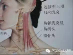 3.锁骨胸骨端,胸锁关节