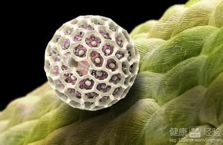 宫颈尖锐湿疣有什么样的症状