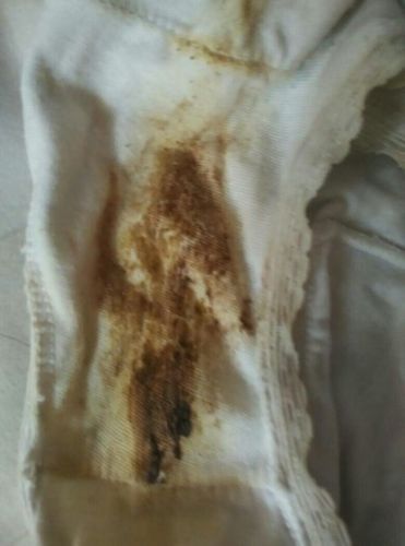 我今年11岁,我感觉自己好像来月经了,但是又好像没有,我的内裤上有一