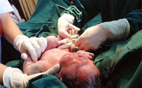 孩子"肚脐眼"里的脏东西能抠吗?懂的人一般不说,但父母要知道