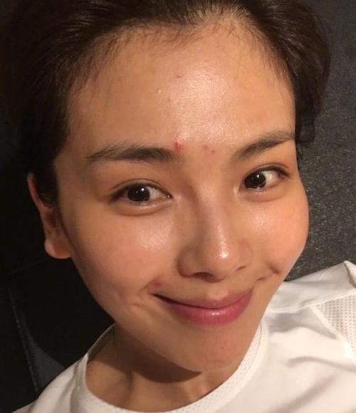 no!看迪丽热巴赵丽颖林允儿脸上的诸多痘痘!