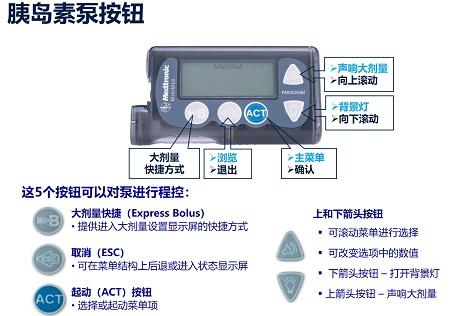 糖友每天还在担心维持血糖水平美敦力胰岛素泵替您解决