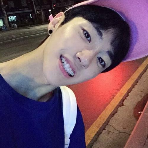 金善斌# #男头# 戴着牙套,还那麽自信