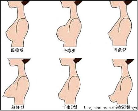 胸部整形让你快速拥有完美乳房