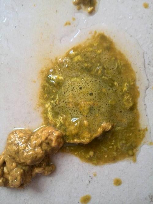 问:请问拉的这样大便,是怎么回事啊?七个半月的宝宝