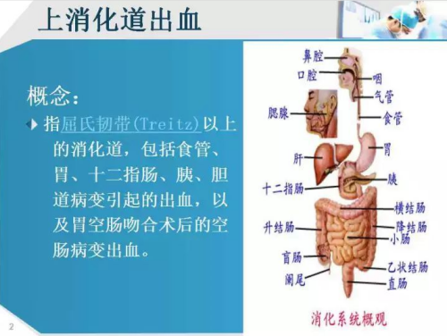 上消化道出血的病因很多,常见病因如下:   1.