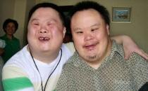 什么是唐氏综合症?