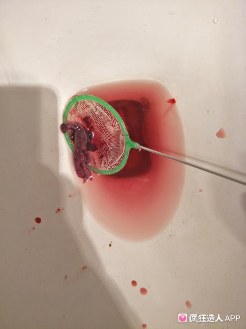          也不知道这个是不是胚胎