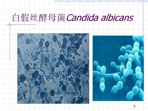 白假丝酵母菌candida albicans