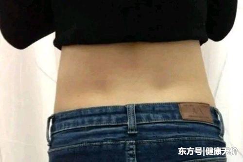 女性后腰上两个"凹点"叫腰窝,这有什么作用
