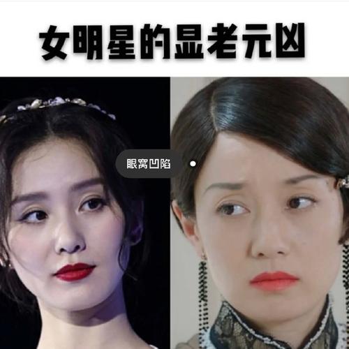 99明星逃不了的显老元凶:眼窝凹陷女明星都是长年带