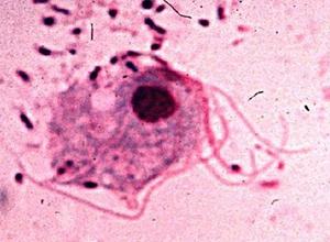 (1836)在妇女阴道分泌物中发现,次年定名为trichomonas vaginalis,本