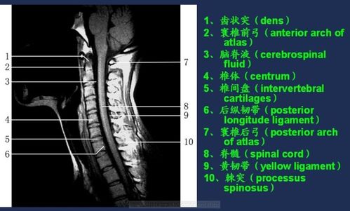 正常影像mri及ct表现解剖图