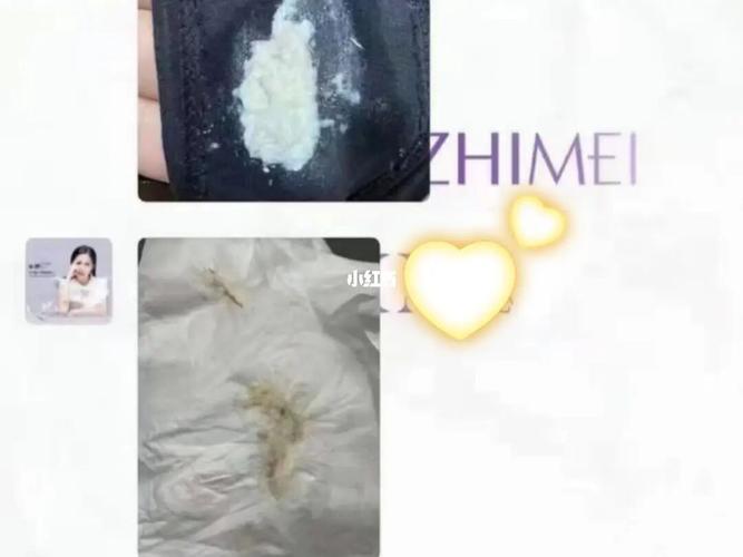 太恶心了,霉菌都排出来_生活记录_接地气生活