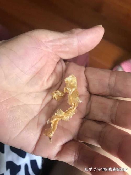 耳屎最大能有多大