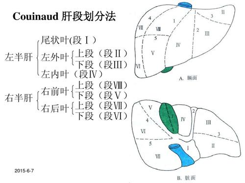 利于肝胆外科影像科医生学习 couinaud 肝段划分法 尾状叶(段Ⅰ) 左半